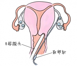 幼儿学画画，郑州捐卵宝宝学画画，学画画的好处，如何学画画